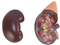 立體器官模型-腎臟